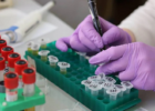 Cancer : les résistances aux traitements, un défi clé pour la recherche