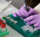 Cancer : les résistances aux traitements, un défi clé pour la recherche